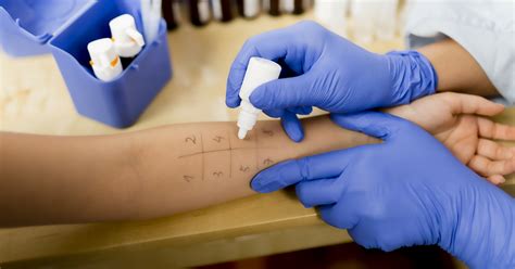 scratch test for allergy|allergy test what to expect.